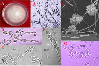 “Multilocus sequence analysis for population diversity of indigenous entomopathogenic fungus Beauveria bassiana and its bio-efficacy against the cassava mite, Tetranychus truncatus Ehara (Acari: Tetranychidae)”